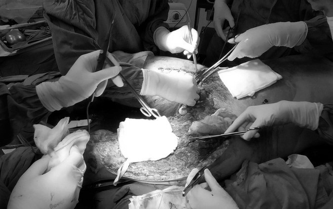 tai nan giao thong giam do phat nang anh 2