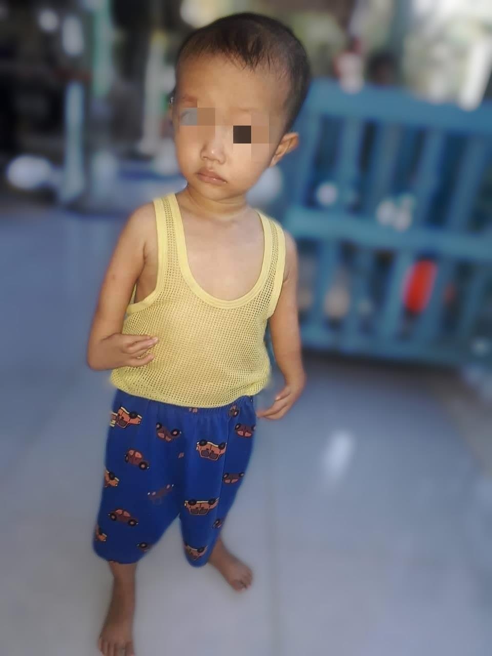 be trai co ban tay chu L anh 1