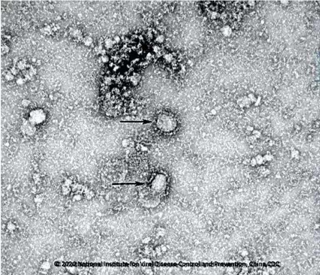 Tiep xuc trong khoang cach 2 m co the lay nhiem virus corona hinh anh