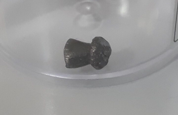 Bi anh ban sung hoi vao lung, be 6 tuoi liet nua nguoi hinh anh