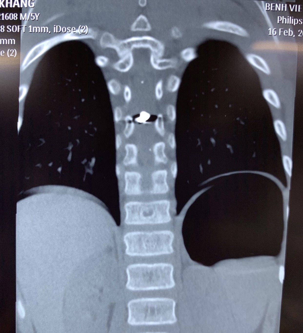 liet nua nguoi do ban sung san anh 1