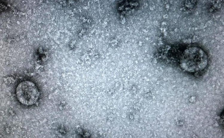 Chot chan cuoi cung ngan virus corona xam nhap vao co the hinh anh