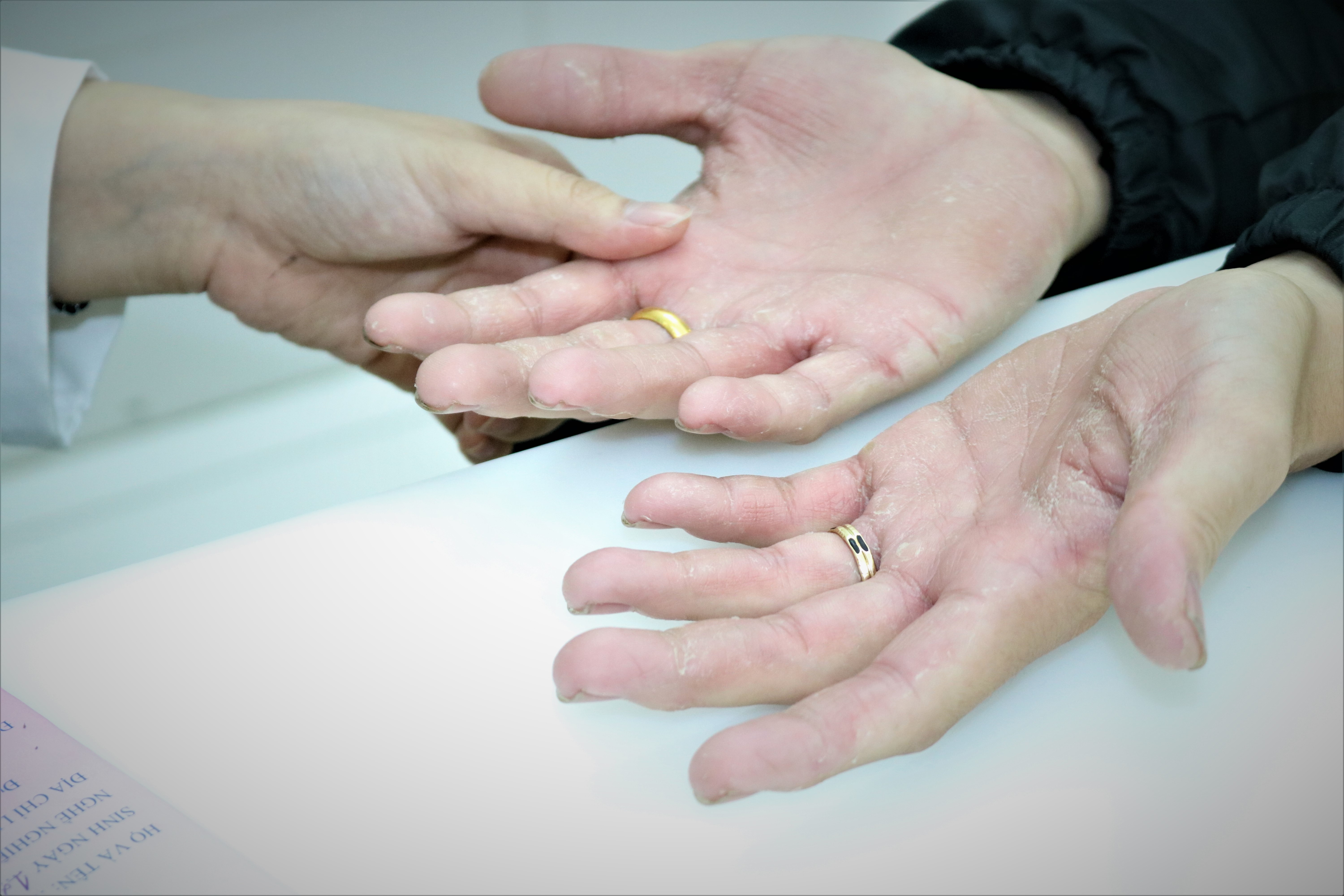 Cach bao ve da tay khi su dung dung dich con sat khuan thuong xuyen hinh anh