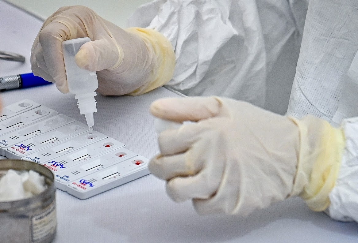 benh nhan duong tinh sau khi am tinh anh 1