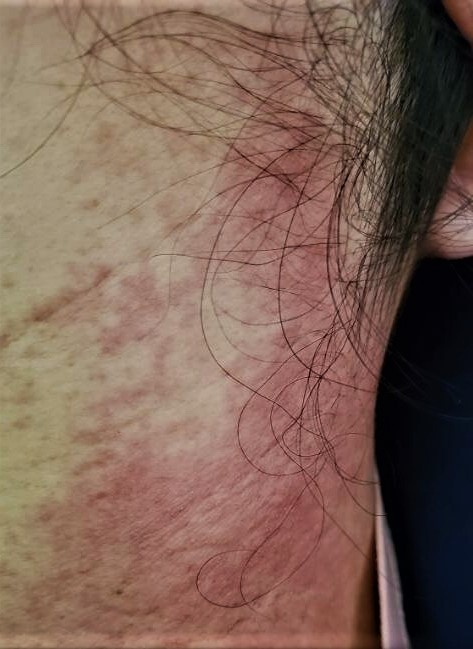 thoa rượu gừng nghệ hạ thổ ảnh 1 thoa ruou gung nghe ha tho anh 1