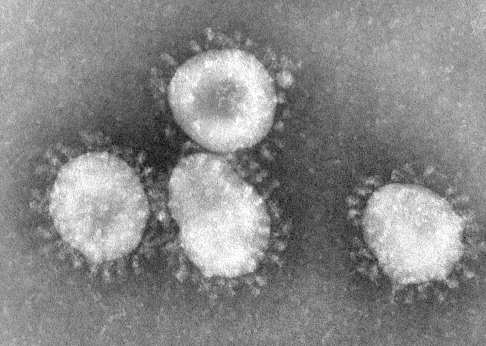 Benh nhan o Da Nang mang chung virus chua tung xuat hien tai Viet Nam hinh anh