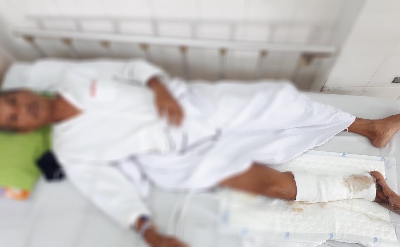 Nguoi dan ong an goi ca ro phi suyt phai cua chan hinh anh