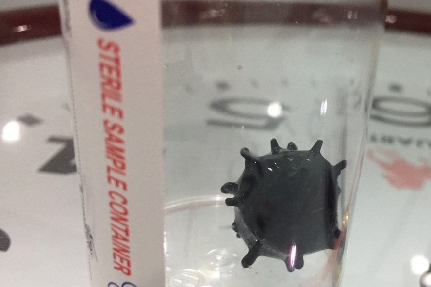 vien soi co hinh giong virus corona anh 1