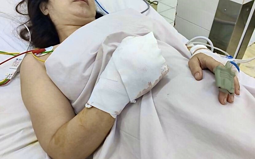 May xay thit nghien nat ban tay nguoi phu nu hinh anh