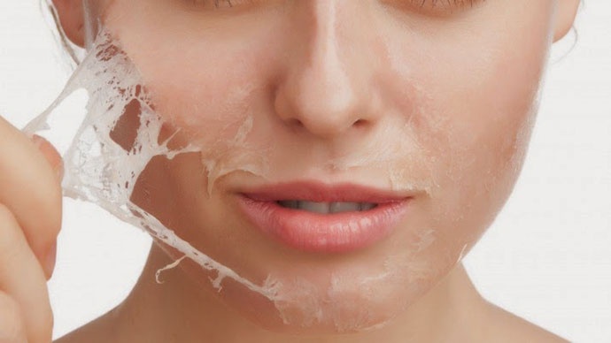 Thieu nu 17 tuoi mat sung phu, lo loet sau khi lot trang da hinh anh