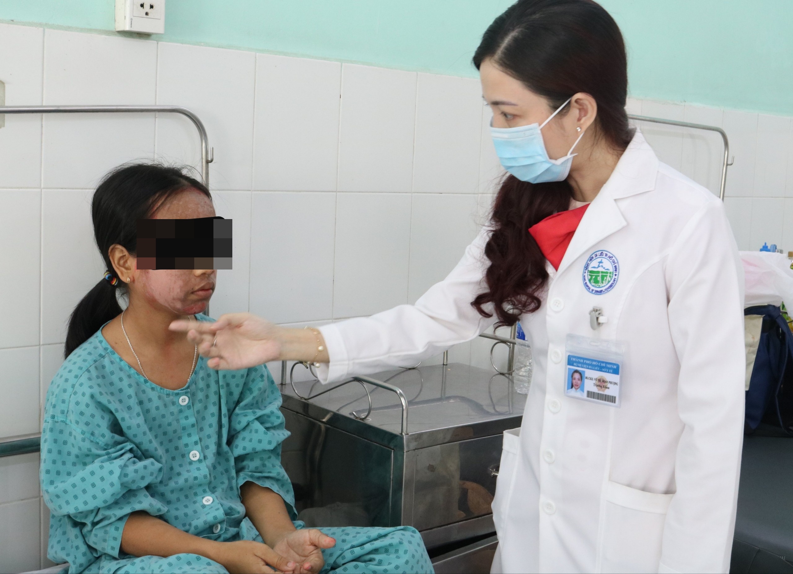 mat lo loet do lot trang da anh 2