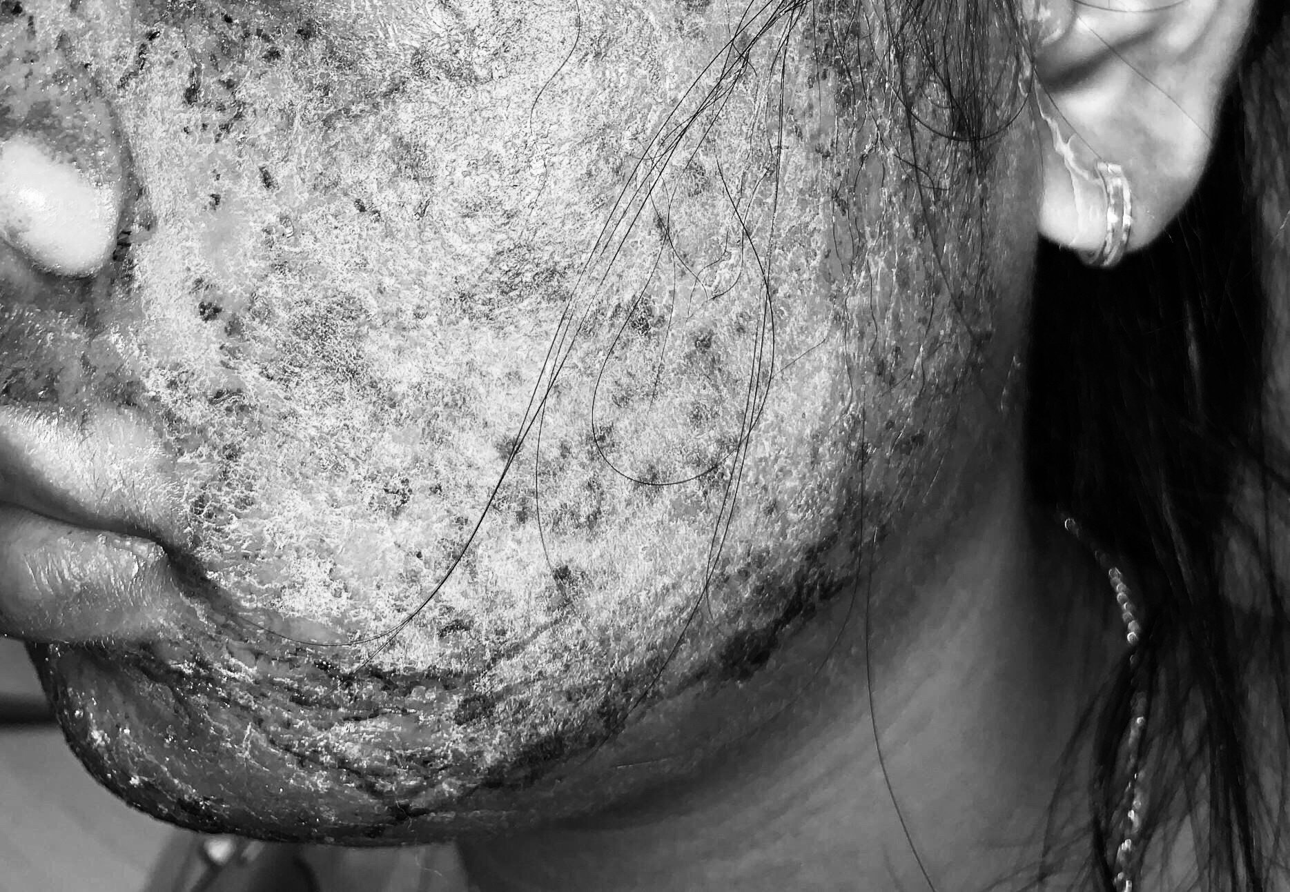 mat lo loet do lot trang da anh 1