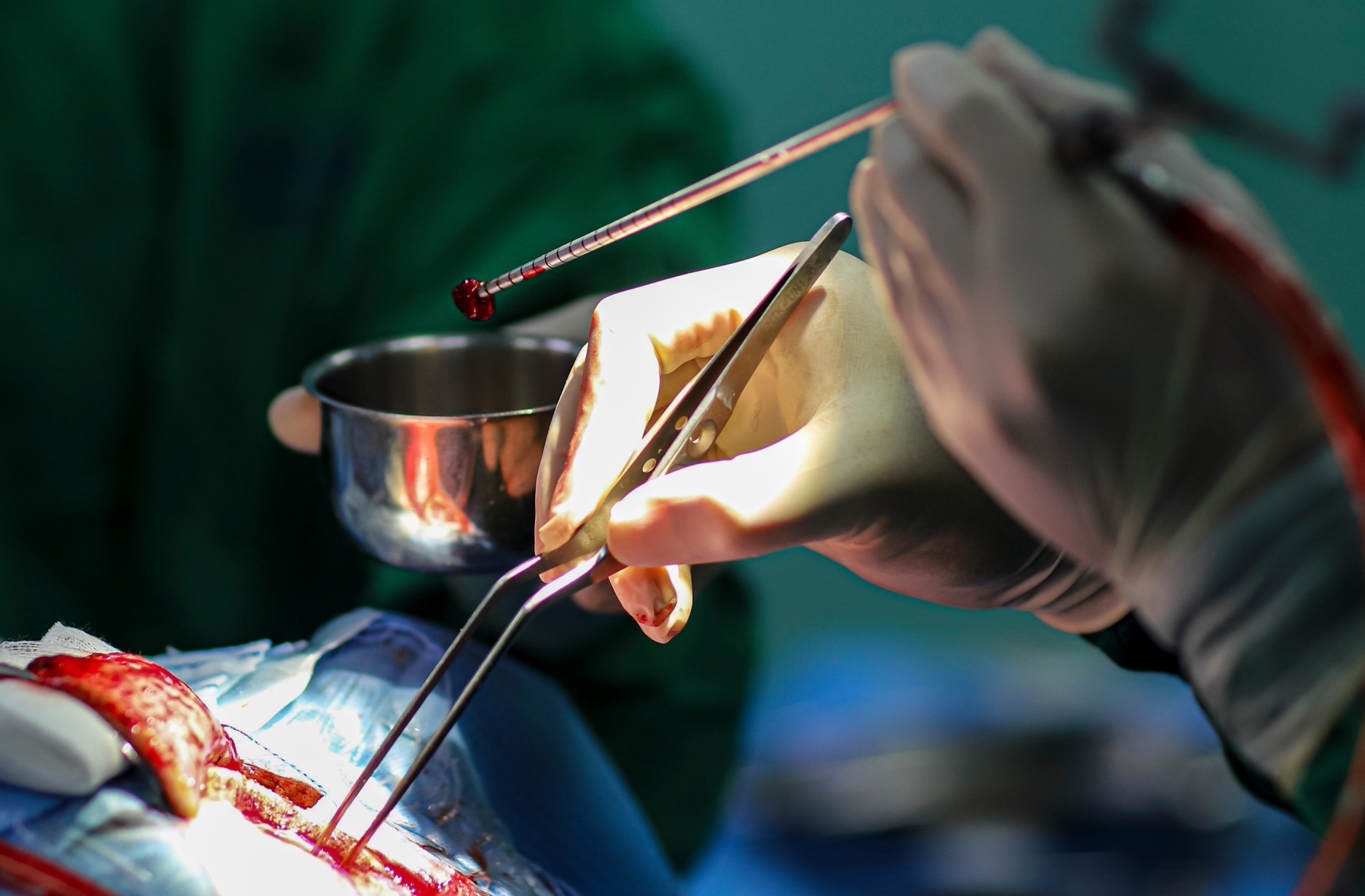 mo nao bang robot anh 14