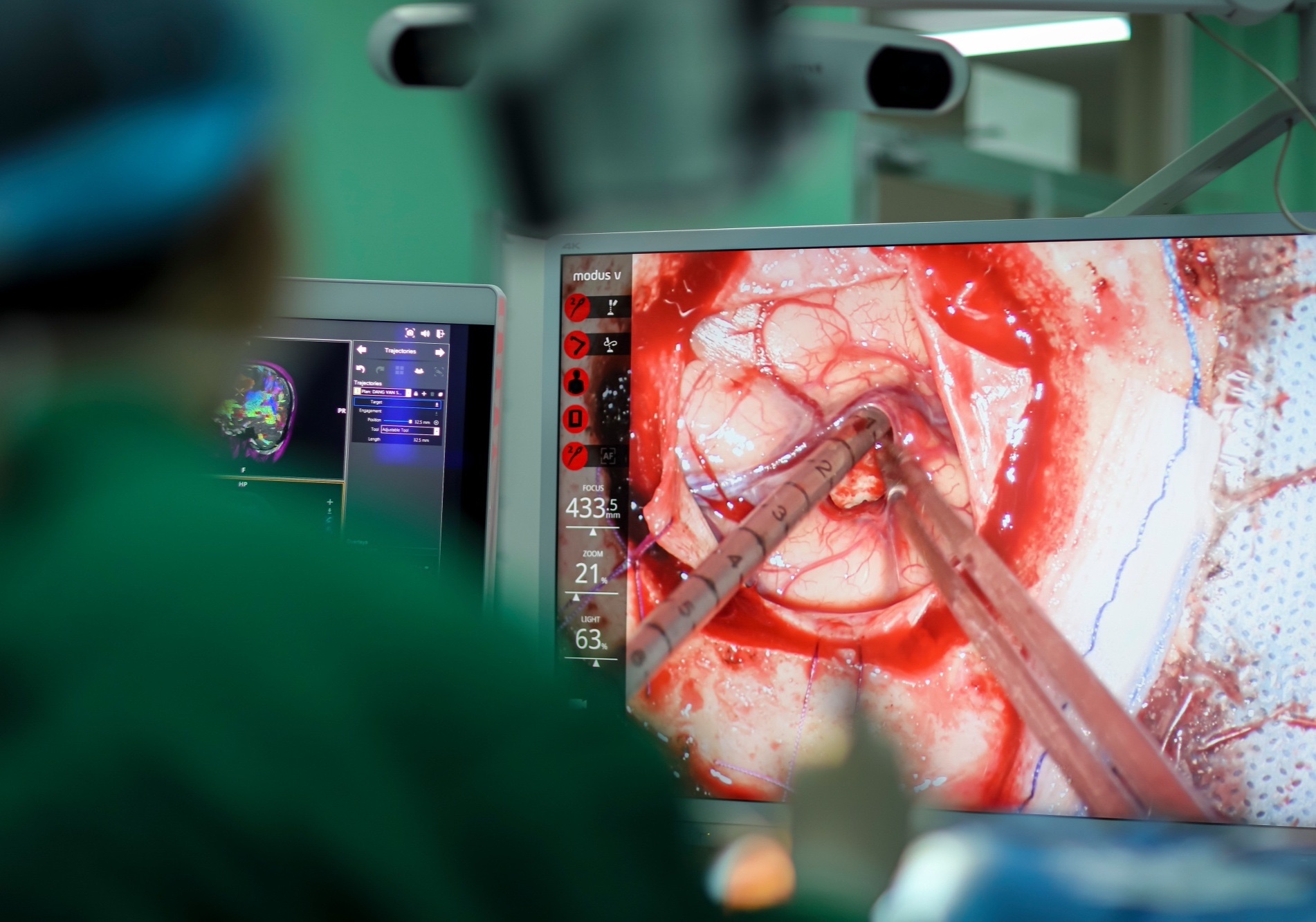 mo nao bang robot anh 15