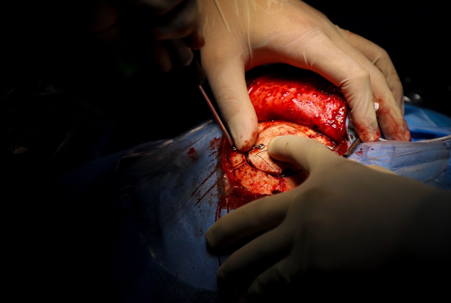 mo nao bang robot anh 16