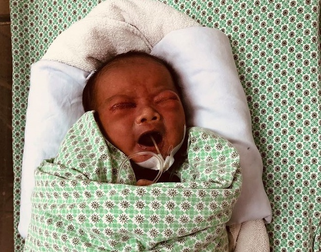 be so sinh bi bo roi song sot anh 1