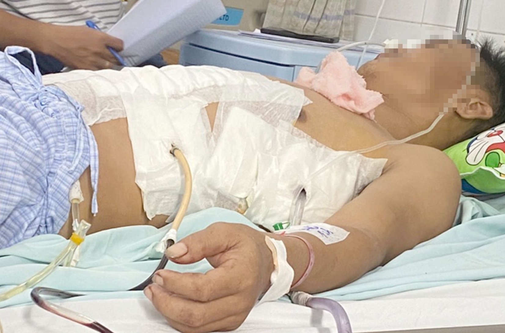 Nguoi dan ong bi dam thung phoi hinh anh