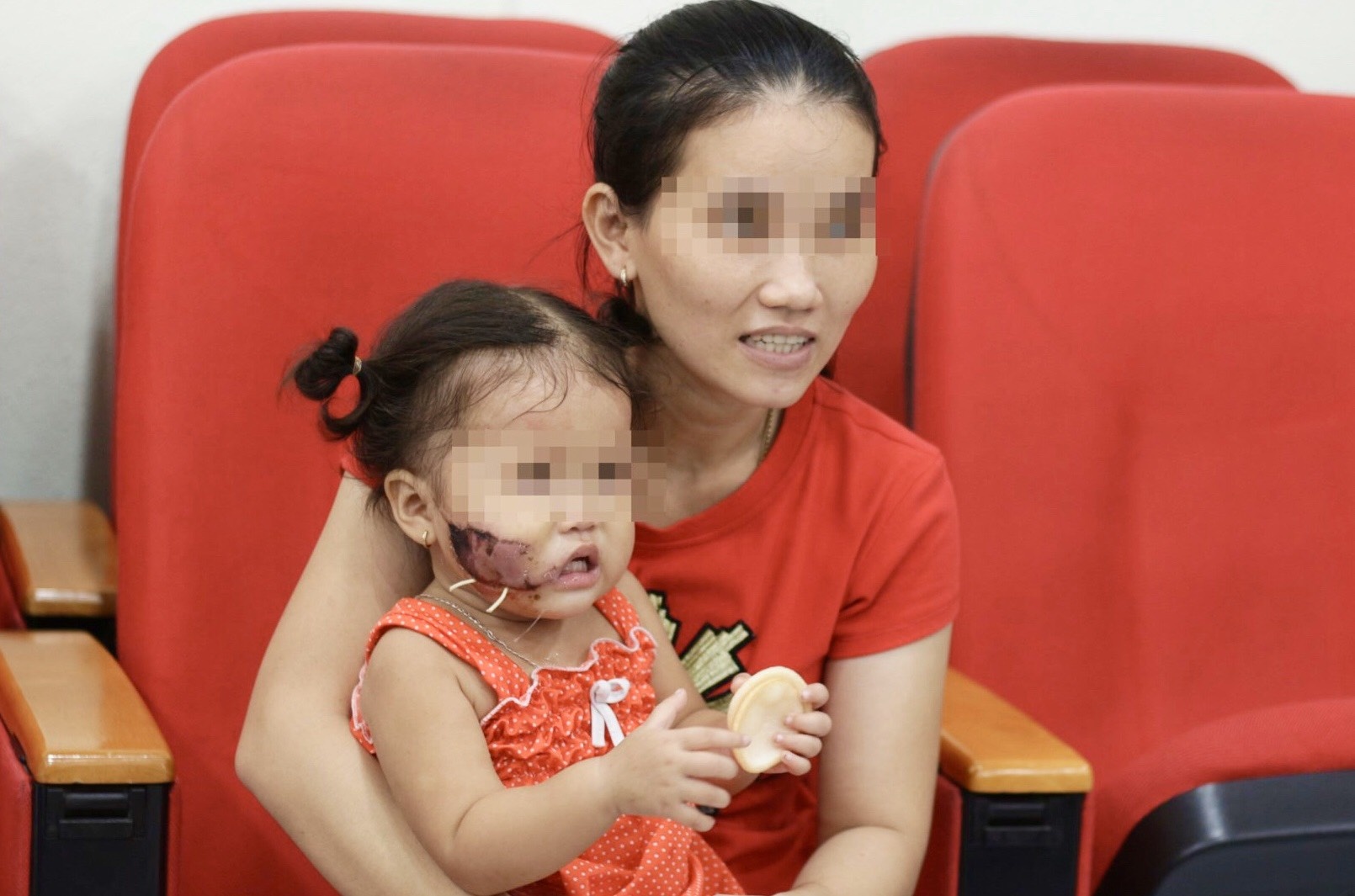 trẻ nhỏ bị chó cắn ảnh 1 tre nho bi cho can anh 1