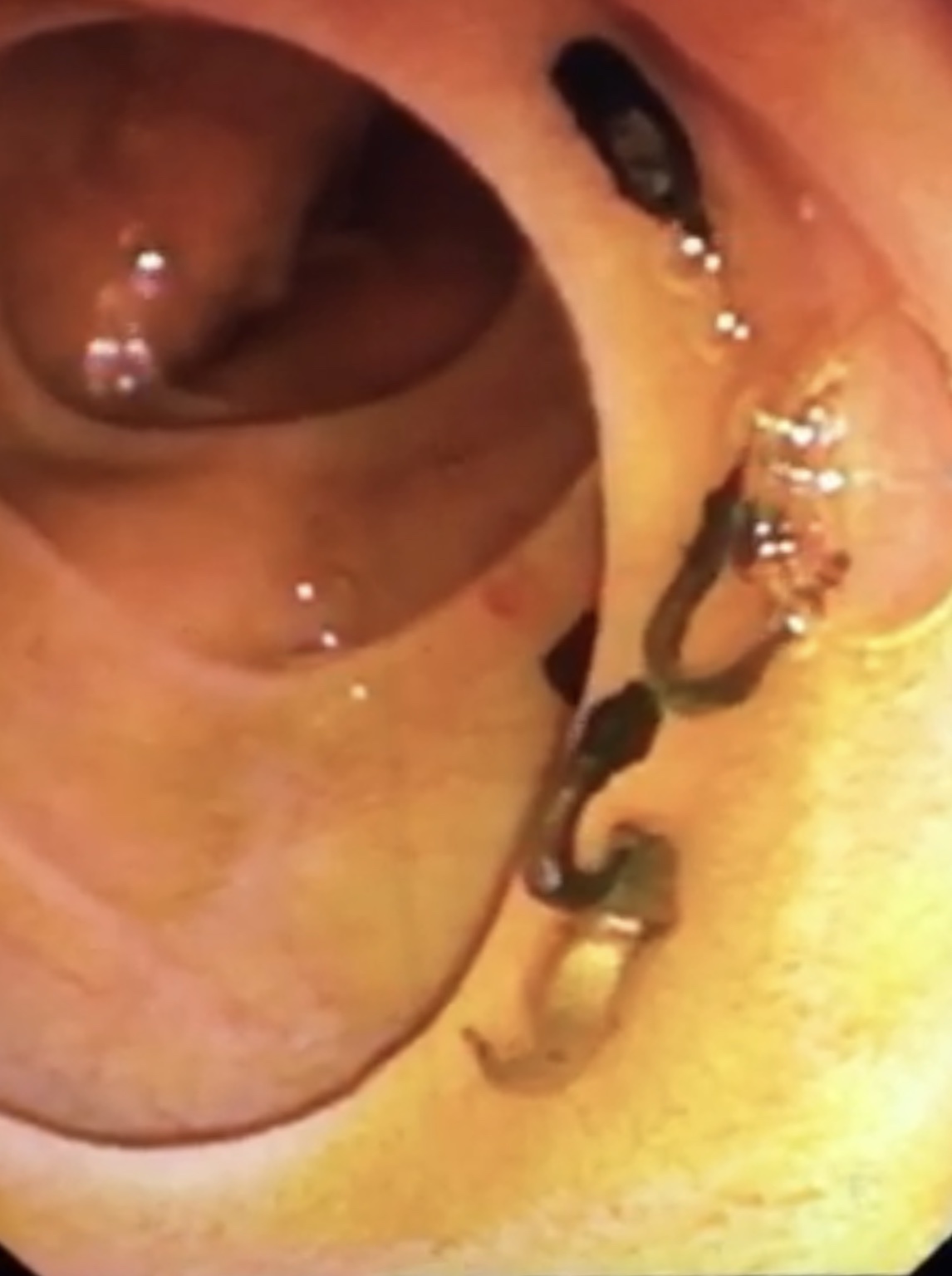 san luc nhuc trong gan anh 1