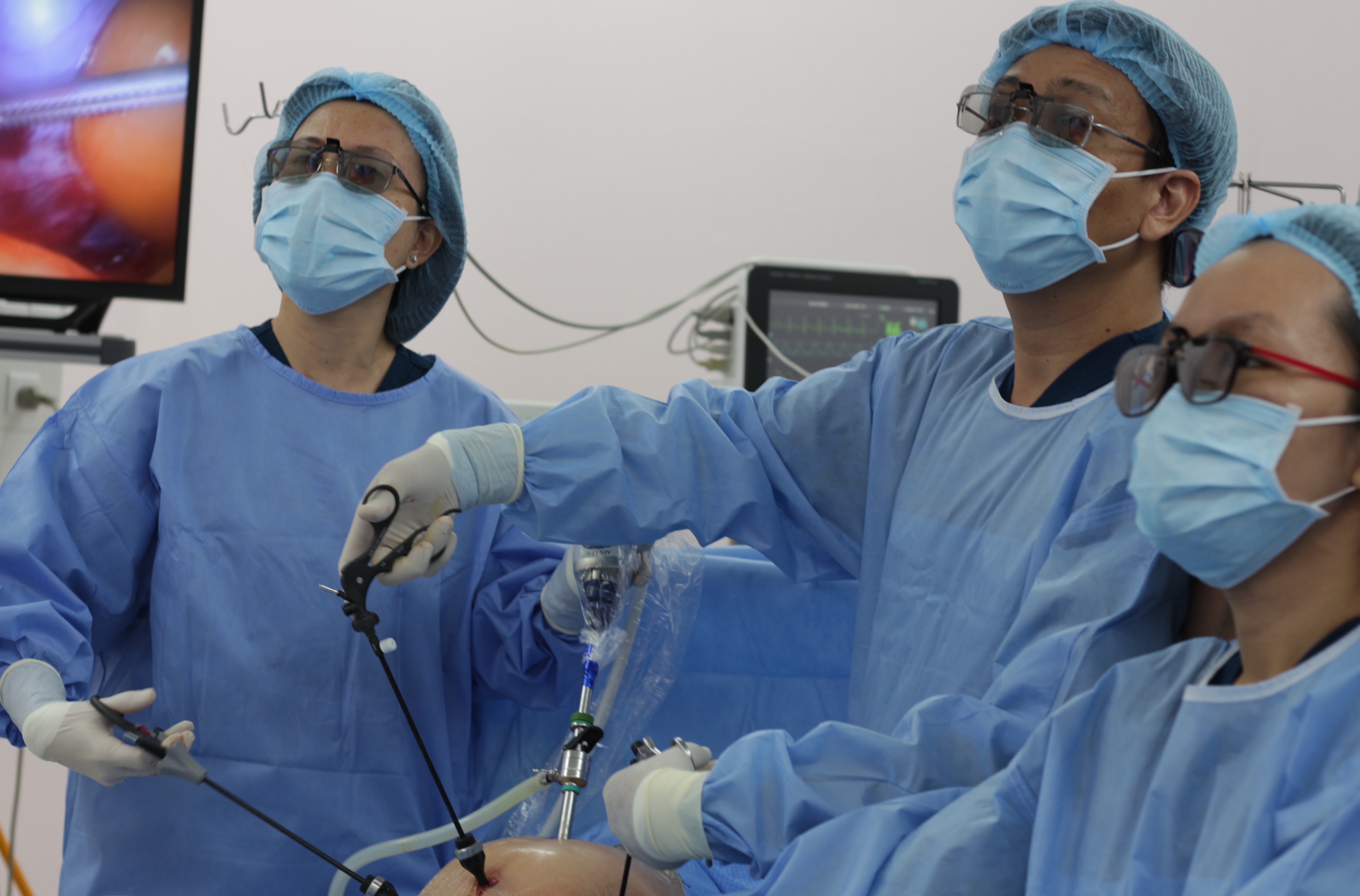 Tuong mo bung hoa ra mac khoi u to o buong trung hinh anh