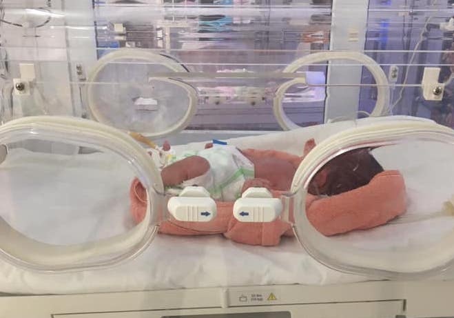 Be gai 1,1 kg nguy kich vi duoc sinh tai nha hinh anh