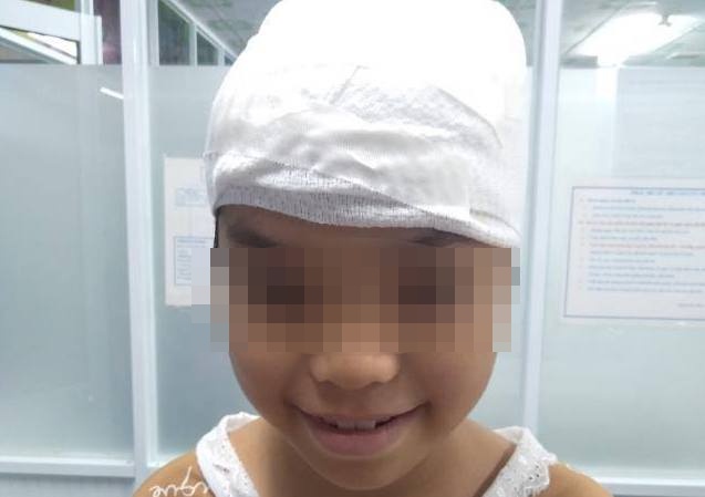 Be gai bi loc da dau do toc cuon vao may xay da hinh anh