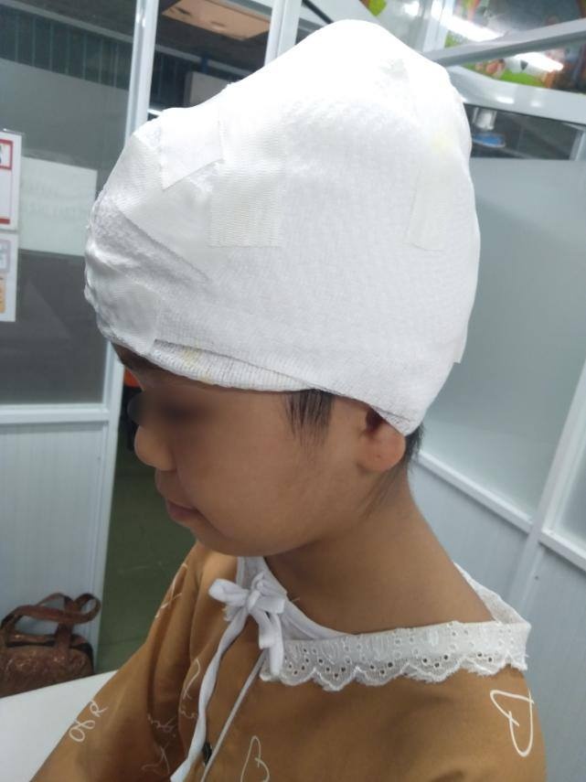 bệnh nhi lóc toàn bộ da đầu ảnh 1 benh nhi loc toan bo da dau anh 1
