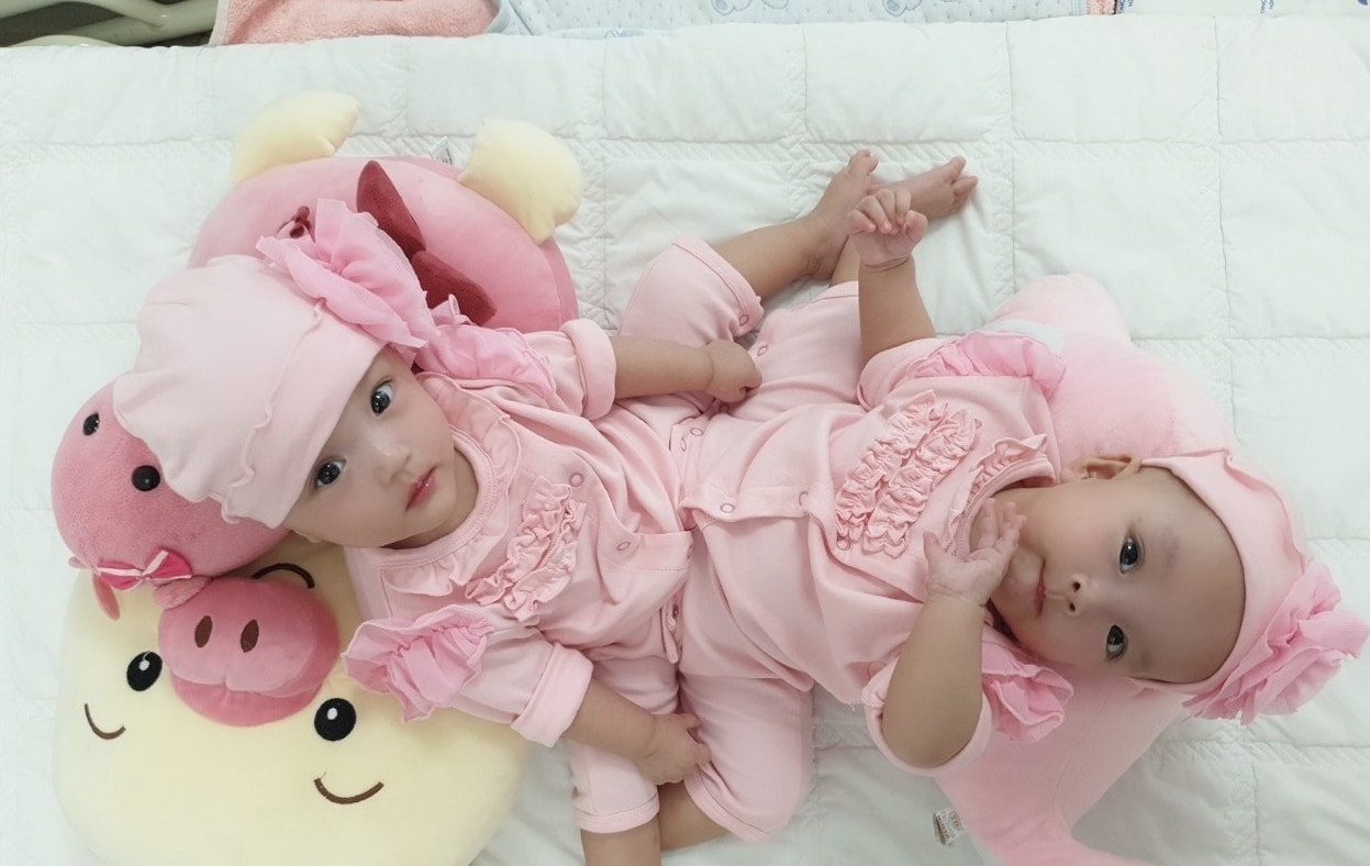 Hon 100 y bac si mo tach roi hai be song sinh dinh lien o TP.HCM hinh anh