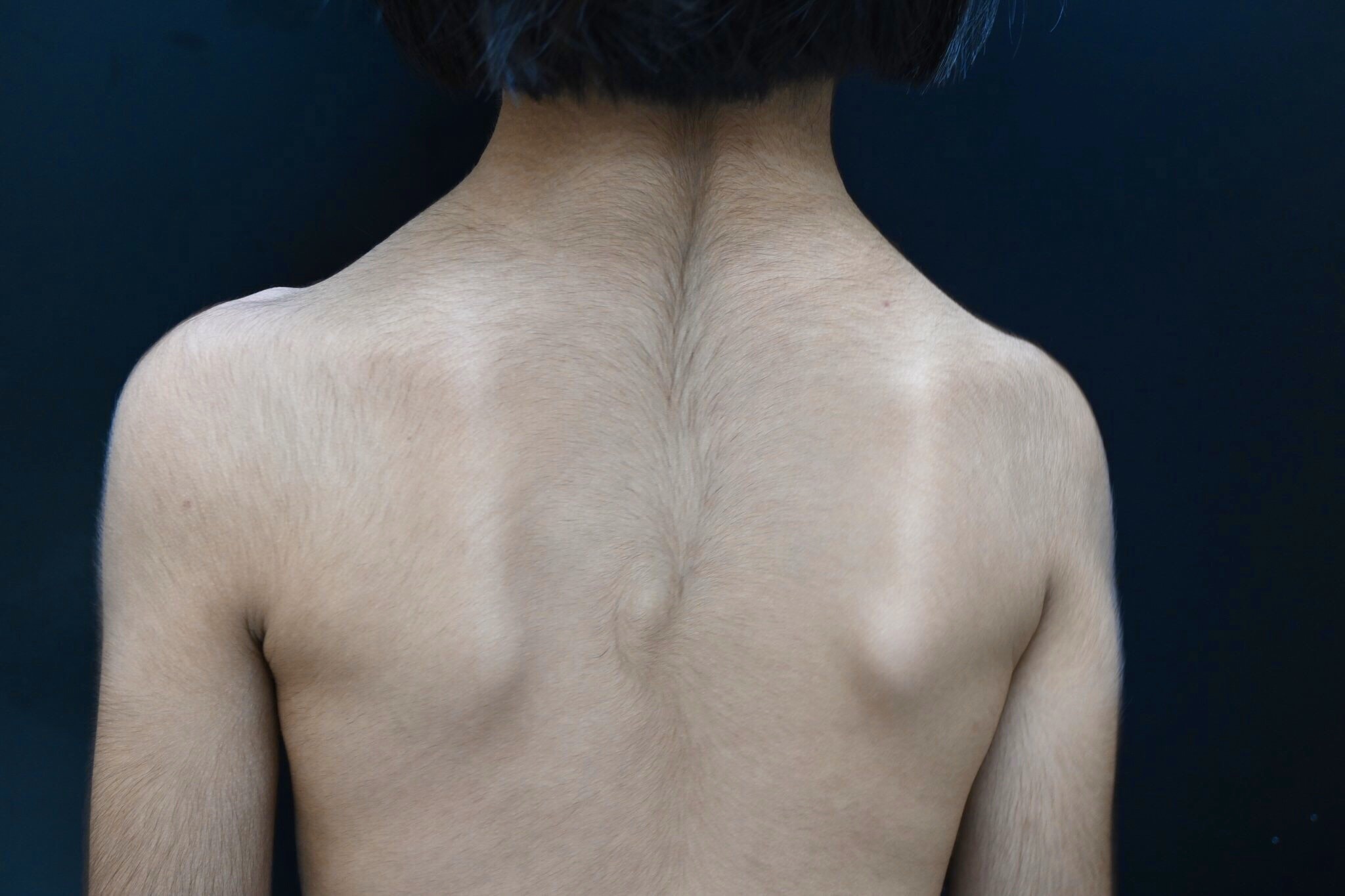 hoi chung Cantu dau tien o Viet Nam anh 1