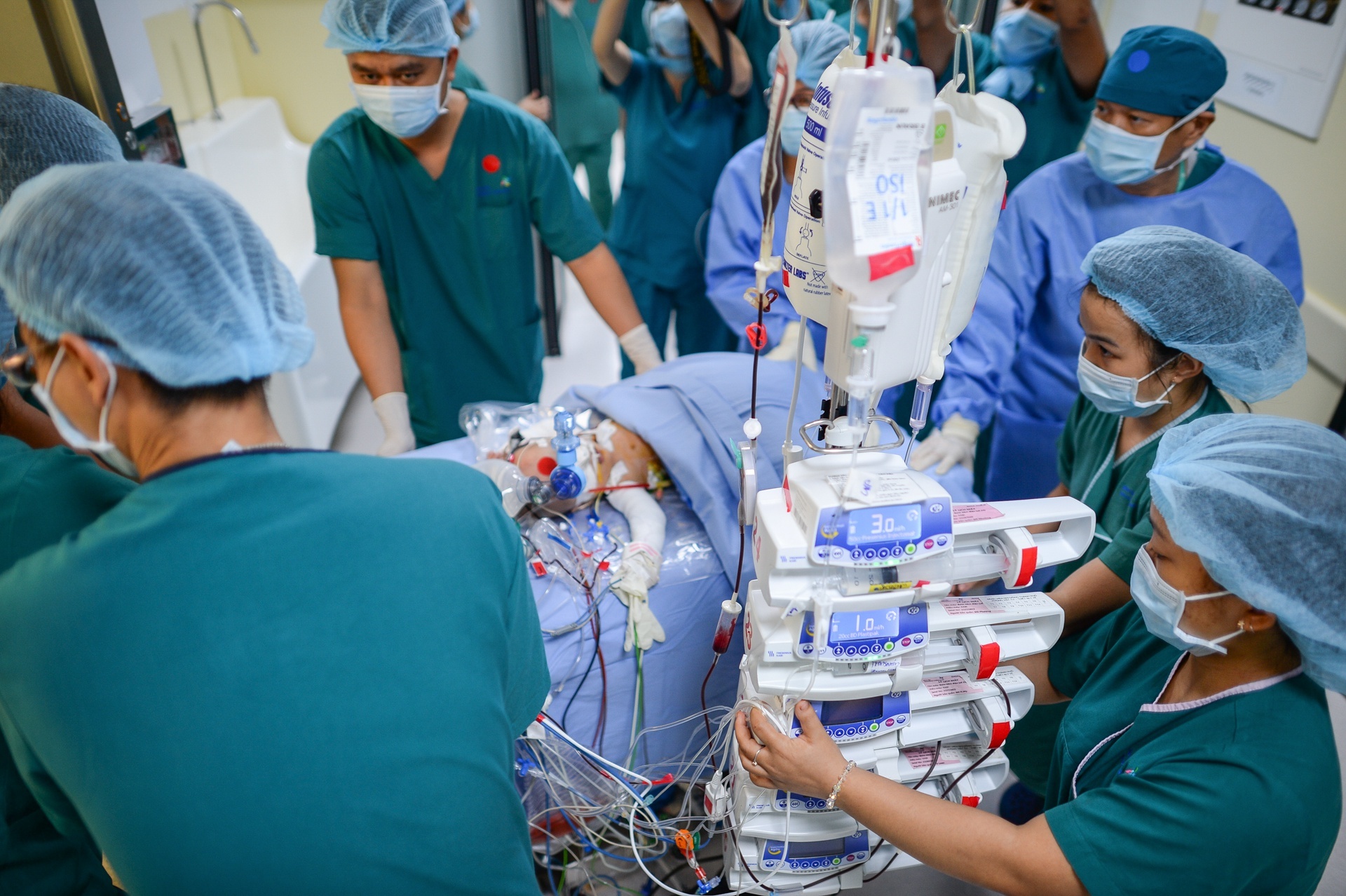 tach song sinh dinh lien anh 1