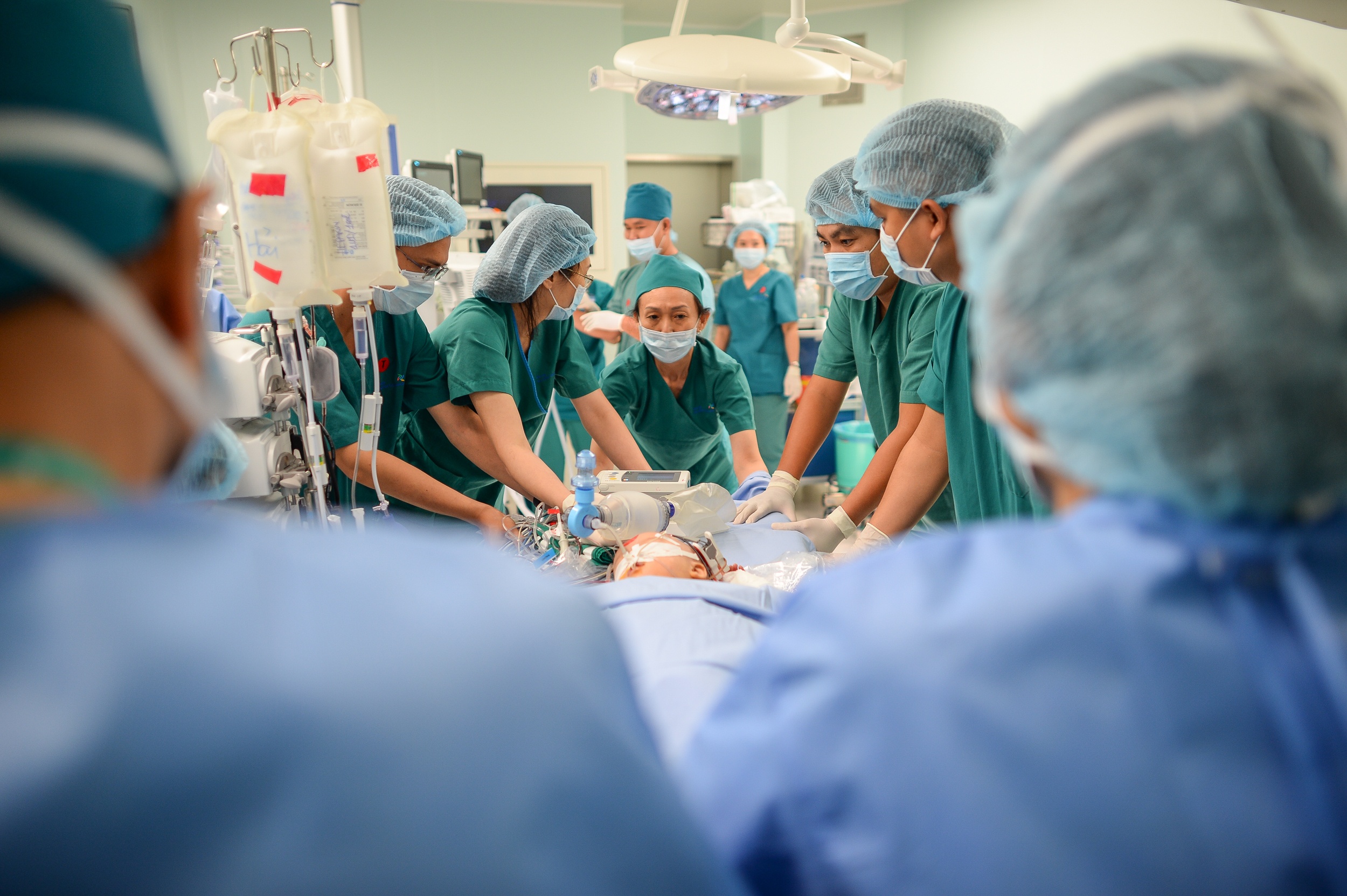 tach song sinh dinh lien anh 1