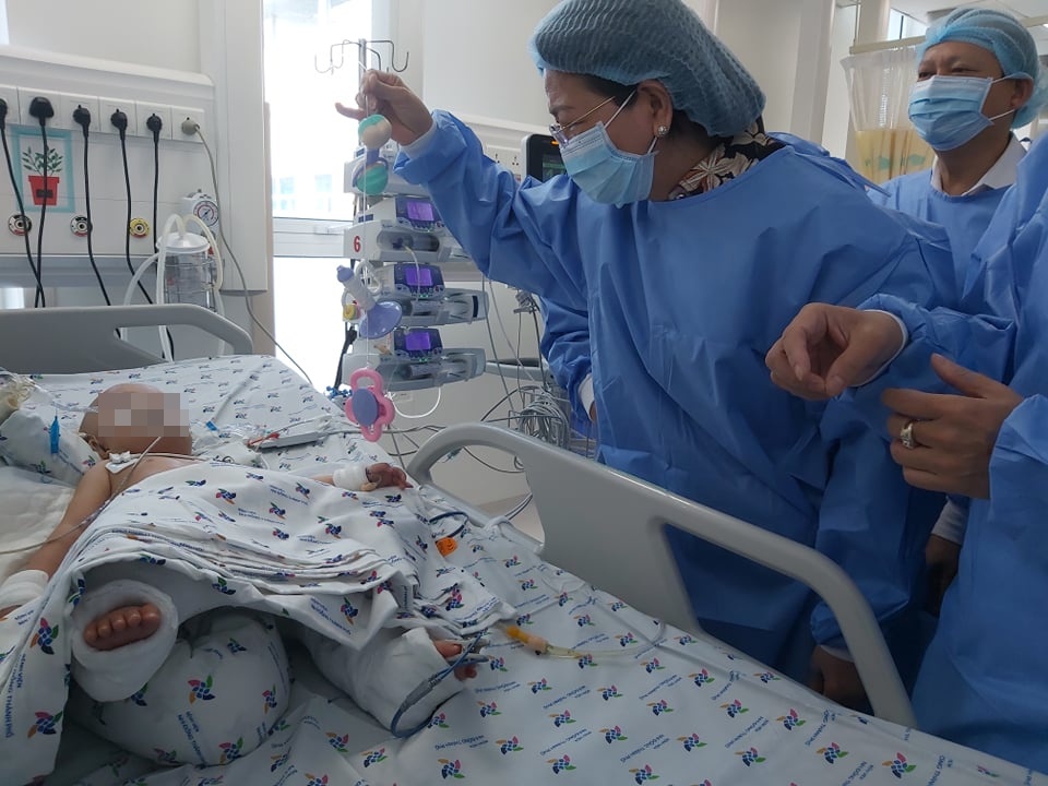 tach cap song sinh dinh lien anh 1