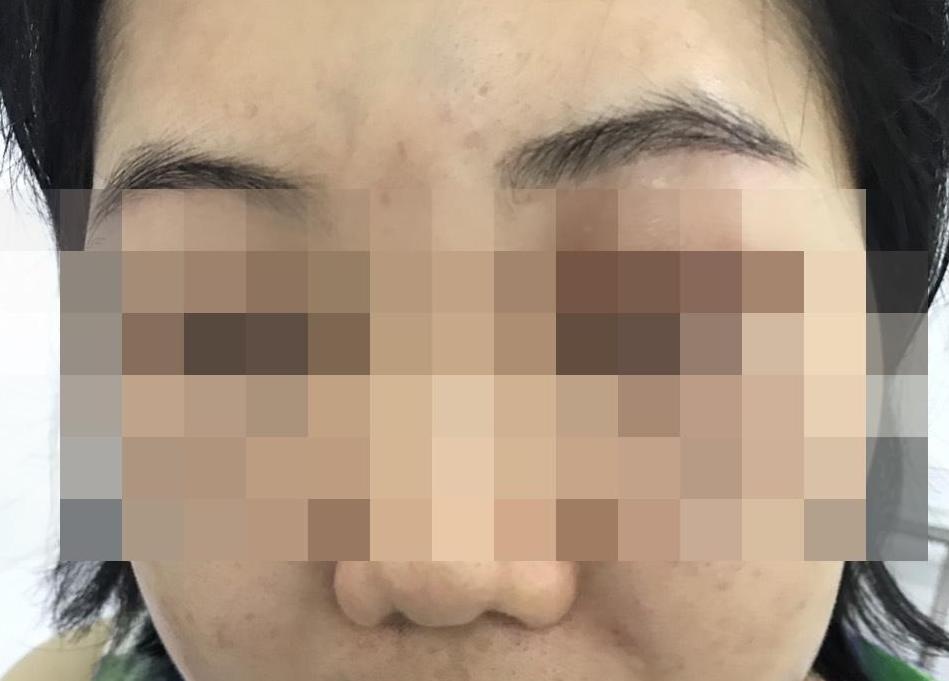 cap cuu do tiem te bao goc lam dep anh 1