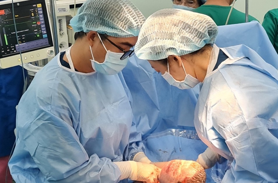 Trẻ sơ sinh có khối u hiếm gặp ảnh 1 Tre so sinh co khoi u hiem gap anh 1