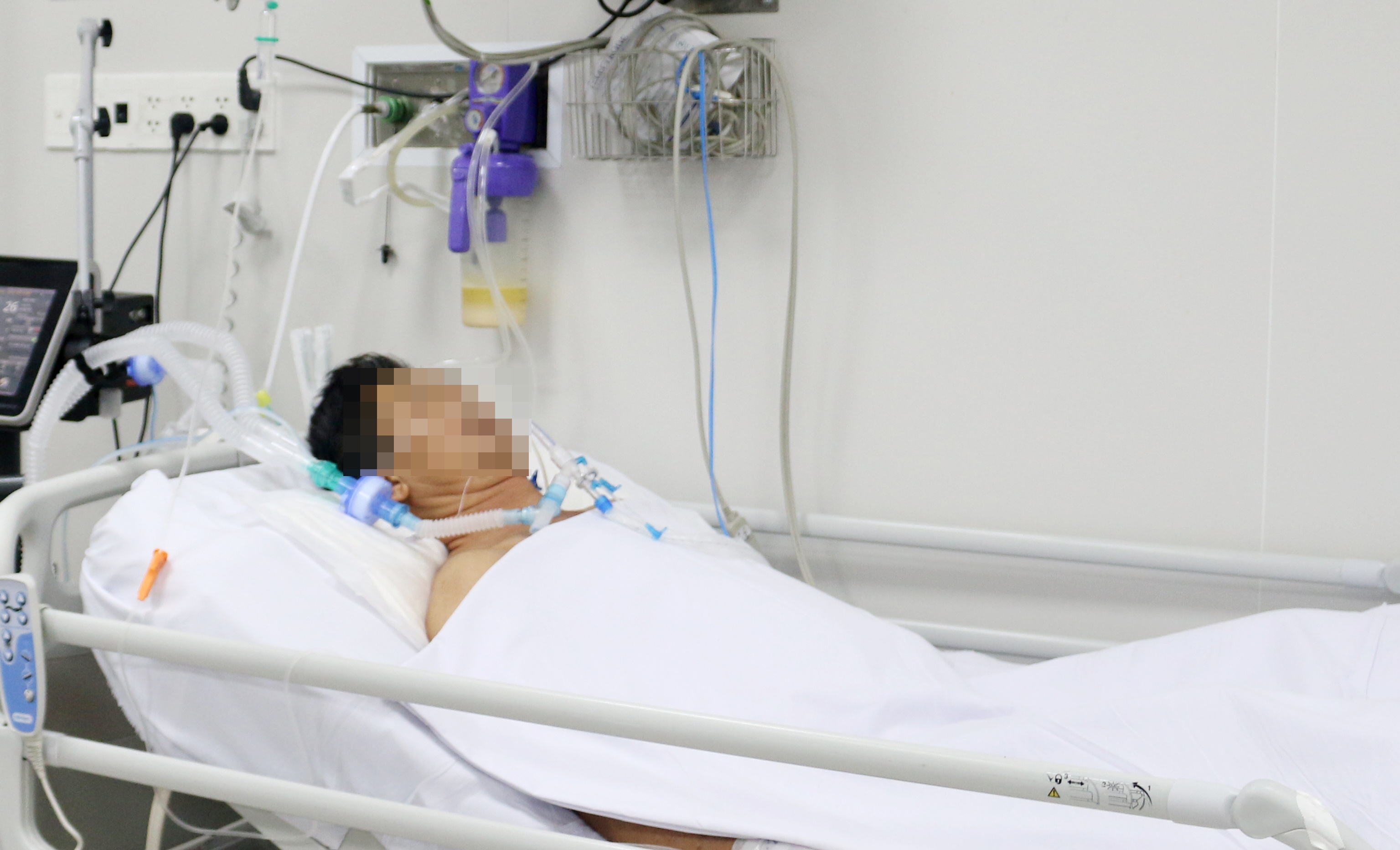 Benh nhan bi ngo doc pate Minh Chay phai nam vien dai ngay hinh anh