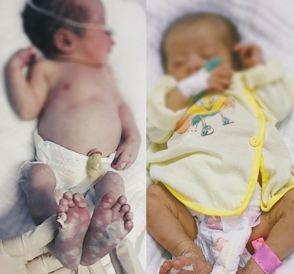 benh lay truyen qua duong tinh duc anh 1