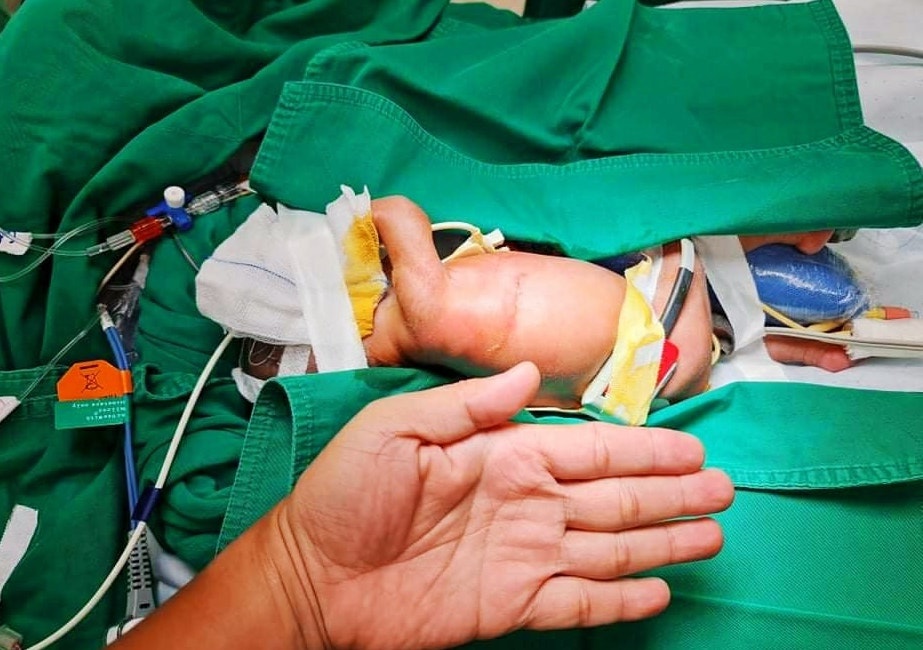 Be gai phai trai qua cuoc dai phau sau 2 ngay chao doi hinh anh