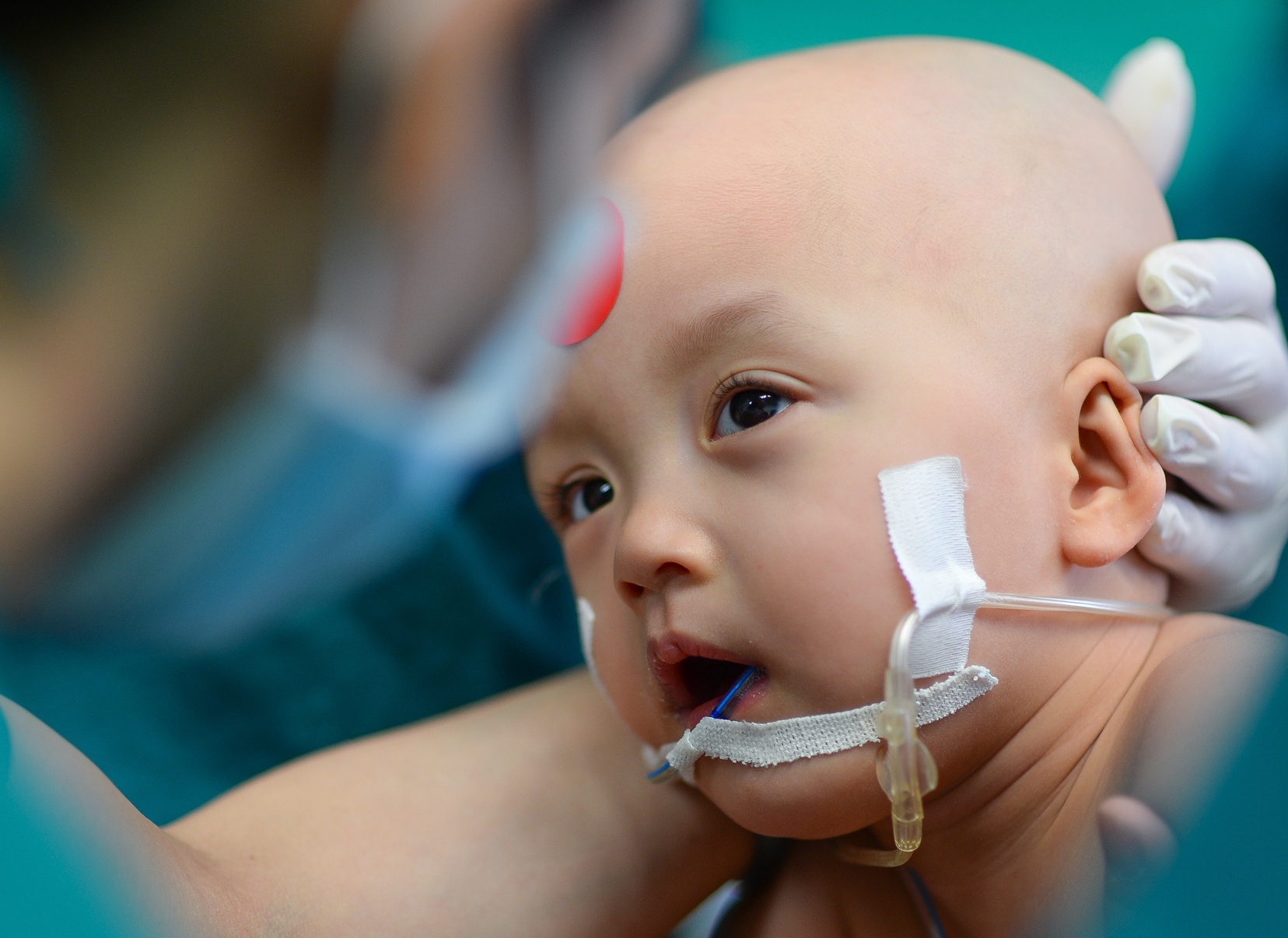 Truc Nhi, Dieu Nhi xuat vien sau 84 ngay duoc tach roi hinh anh