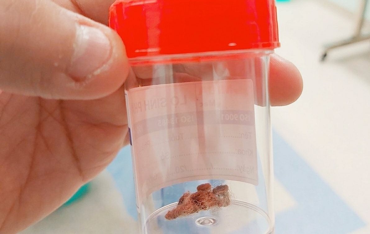 Mieng bong gon ket trong am dao be gai hinh anh