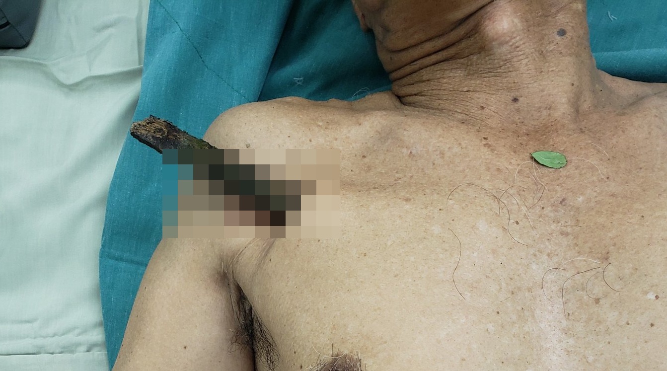 cay go dai 30 cm dam xuyen phoi anh 1