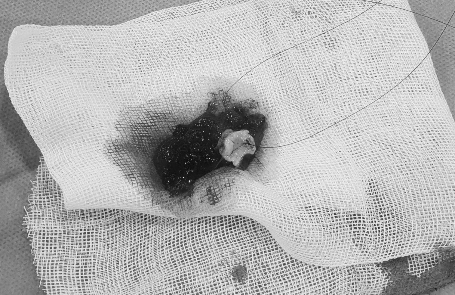 Nguoi dan ong co u nhay hiem gap trong tim hinh anh