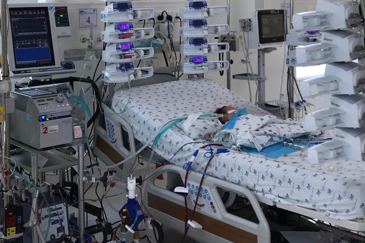 ECMO và lọc máu cứu bé sơ sinh ảnh 1 ECMO va loc mau cuu be so sinh anh 1