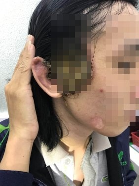 So nguoi kham benh lay qua duong tinh duc o BV Da lieu TP.HCM tang cao hinh anh