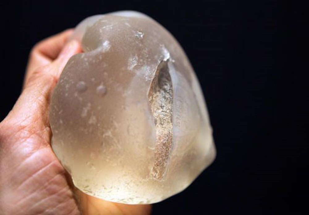 Nguoi phu nu o TP.HCM bi vo tui don nguc hinh anh