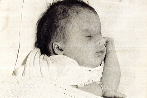 nhung nguoi mac hoi chung Seckel anh 1