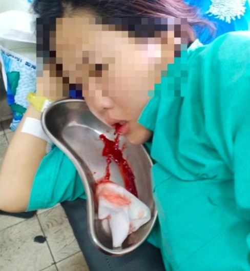 ung thu vom hau khi mang thai anh 2