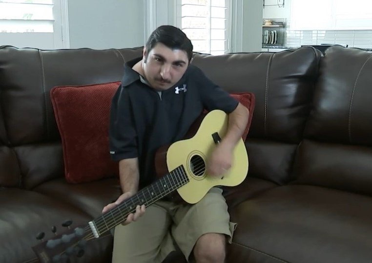 nhung nguoi mac hoi chung Seckel anh 2