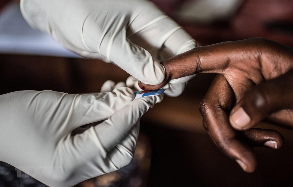 Ai có nguy cơ nhiễm HIV  ảnh 1 Ai co nguy co nhiem HIV anh 1