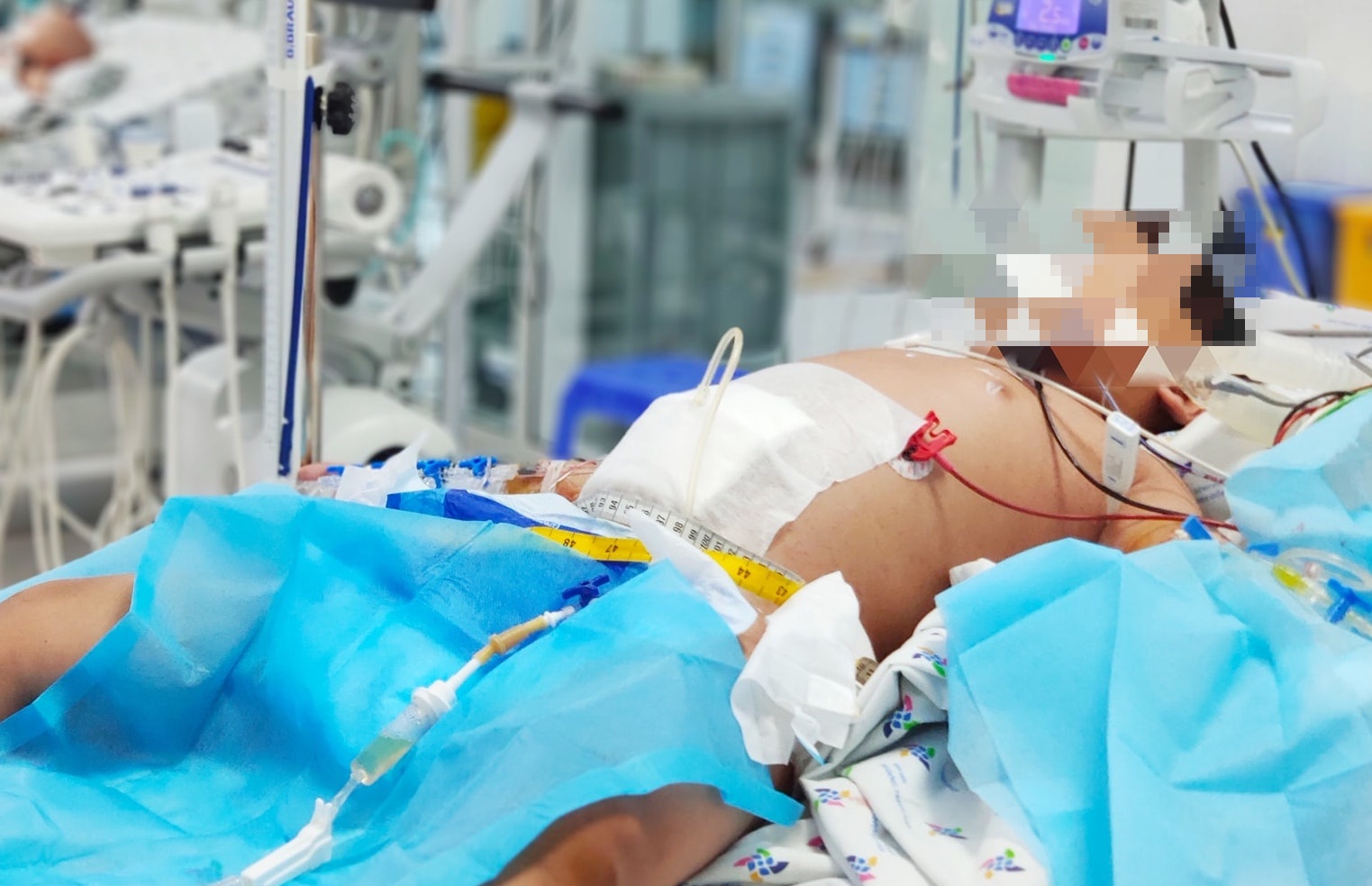 bé trai sốt xuất huyết biến chứng ảnh 1 be trai sot xuat huyet bien chung anh 1