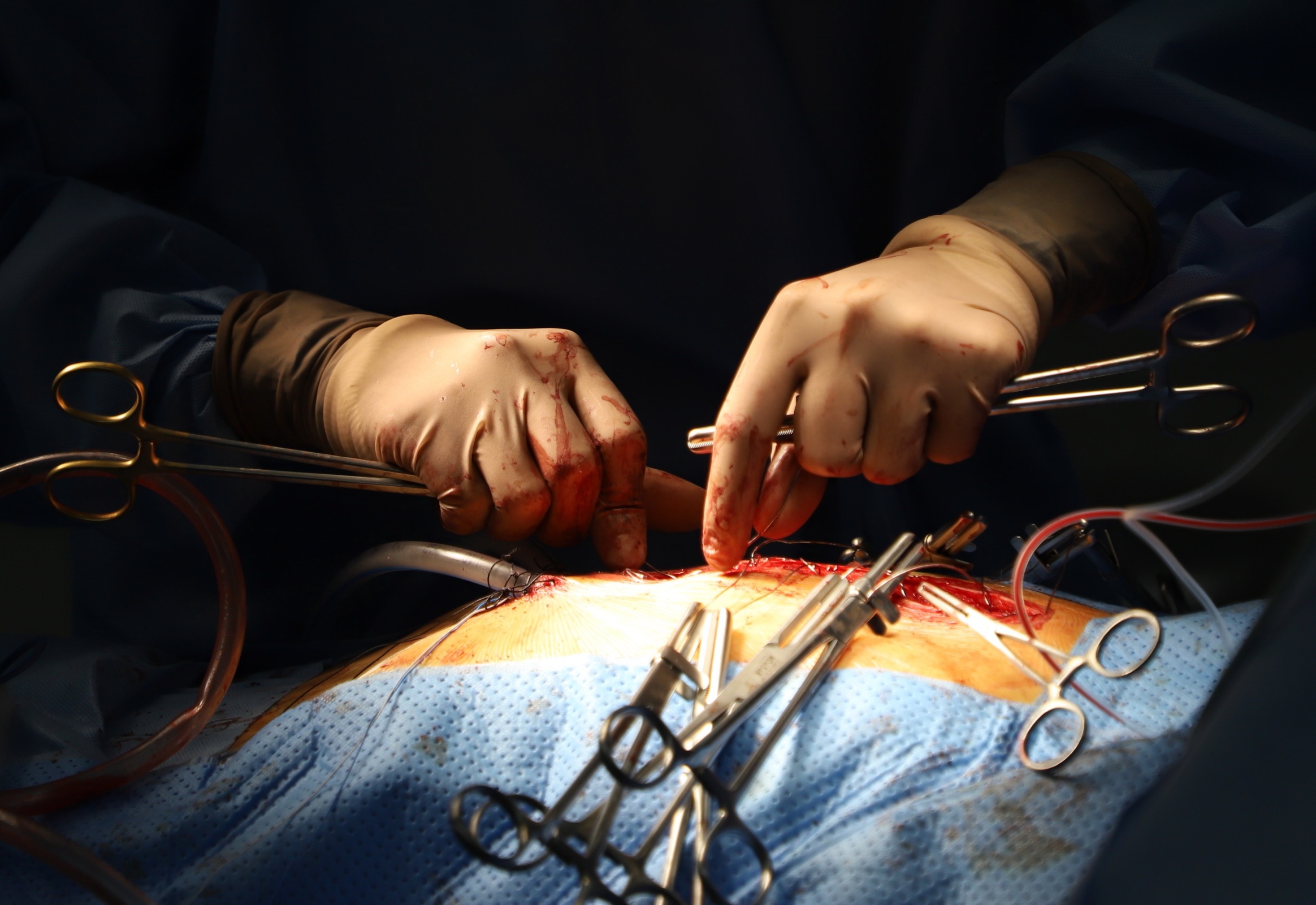 ky thuat lan dau duoc ap dung tai Viet Nam anh 1